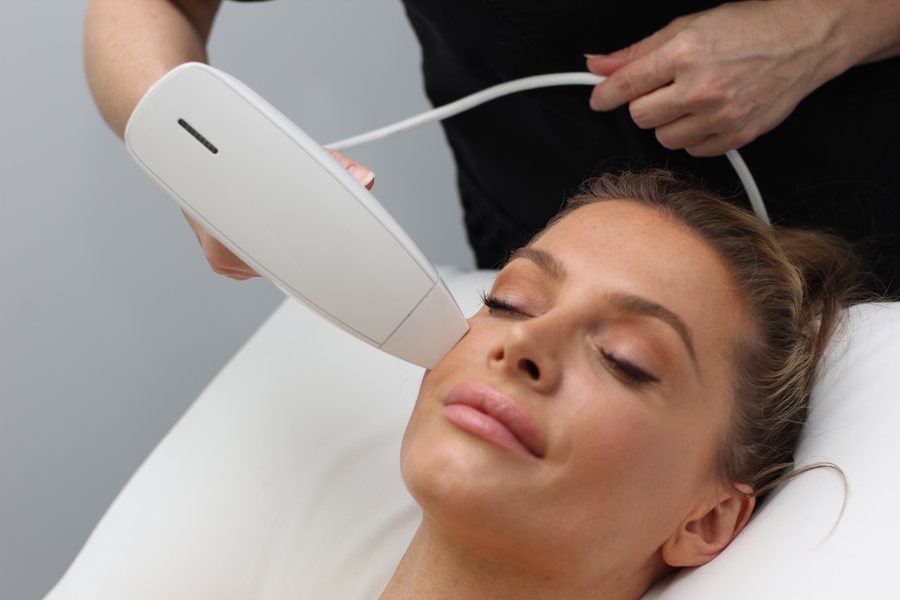 Venus Viva MD skin resurfacing